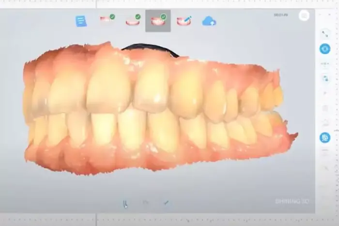 Diş hekimliğinde 3D tarayıcı ile ölçü alma derdi geride kaldı!