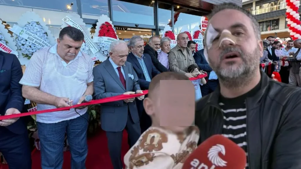 Burger King açılışında Dr Kemal Sağlam saldırıya uğradı