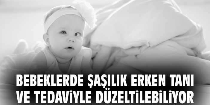 Bebeklerde Şaşılık, Erken Tanı ve Tedaviyle Düzeltilebiliyor